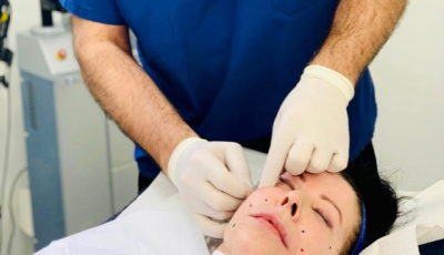 A medical professional in blue scrubs performing a cosmetic procedure on a patient lying on a treatment table, wearing gloves.
