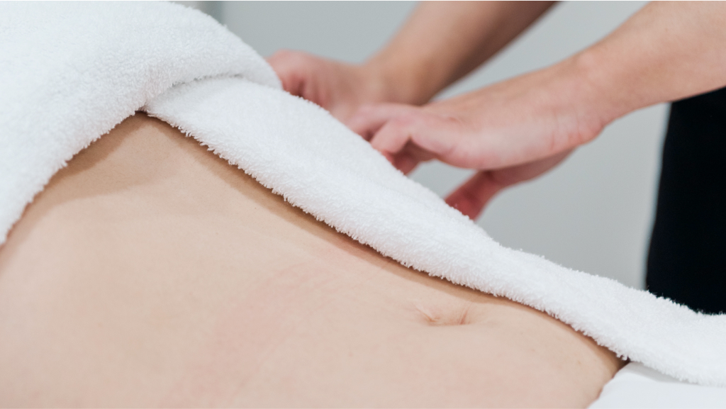 a woman that had liposuction 10 years ago