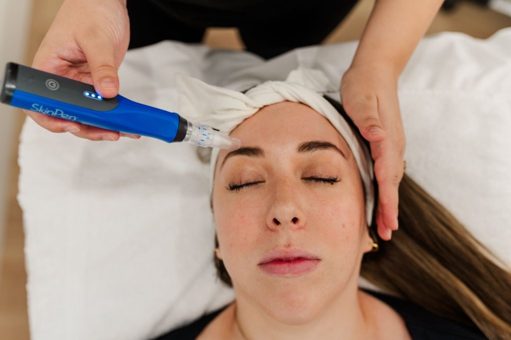 microneedling at Yazdani Aesthetics