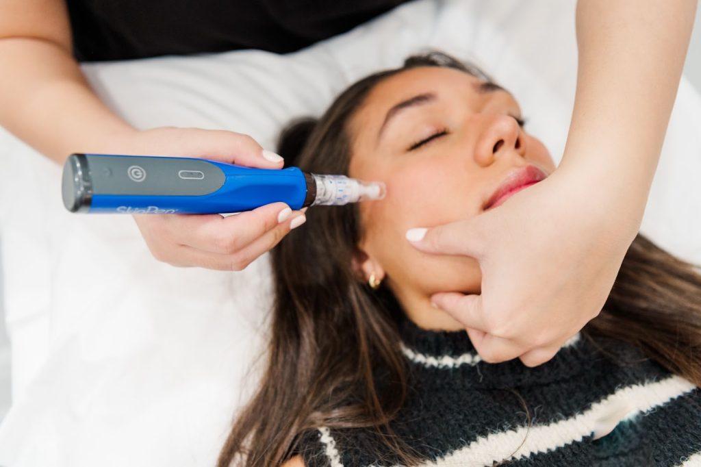 microneedling service