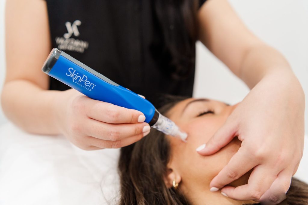 microneedling treatment